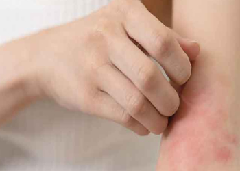 شایع ترین عوارض پوستی دیابت + روش‌های کنترل و درمان 