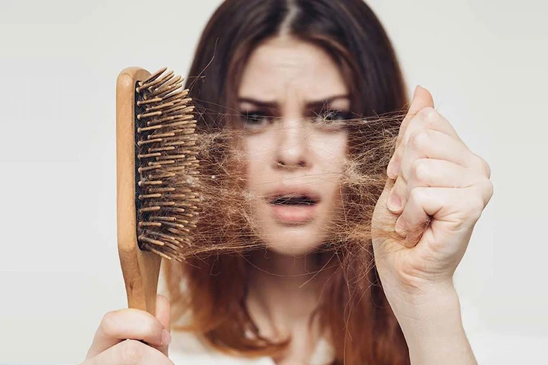 تصویری از ریزش مو